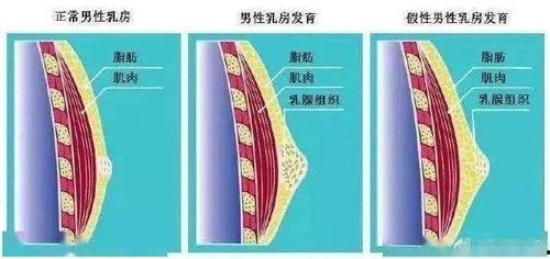男性乳房发育的明星